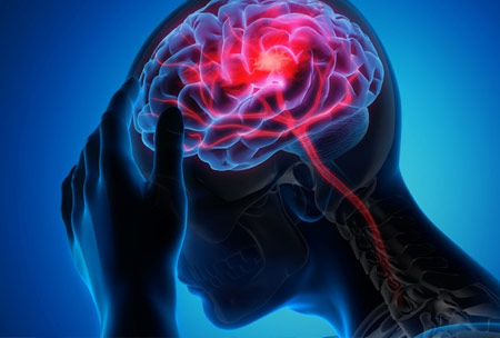 Test Neurocognitivo