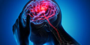Test Neurocognitivo Test Neurocognitivo